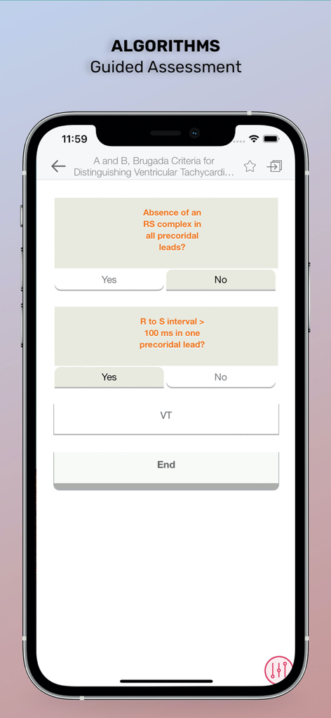Washington Manual Medical Ther - A guided clinical assessment algorithm for Brugada Criteria within the Washington Manual medical app
