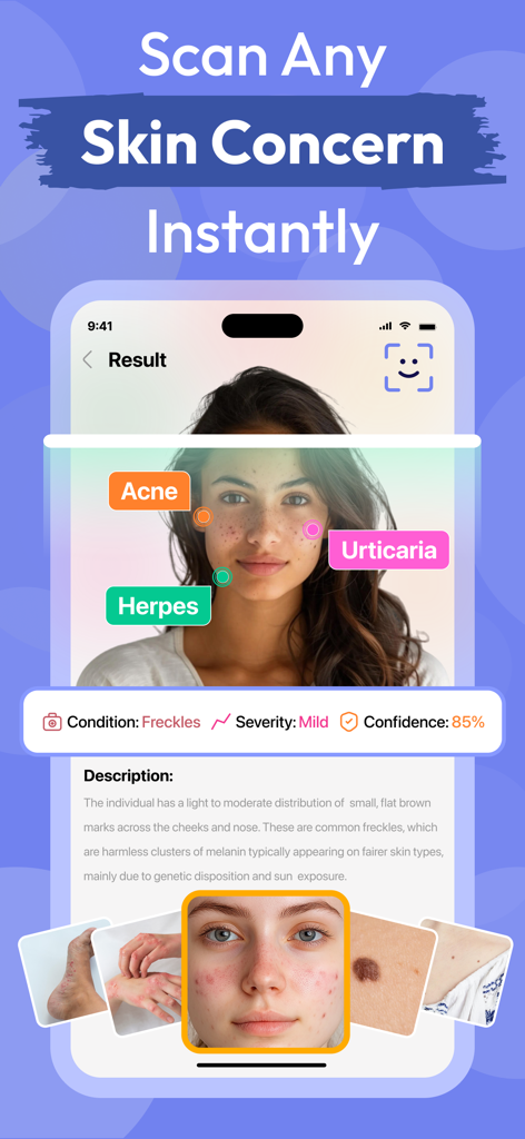 A mobile app interface showing an AI-powered skin analysis that detects skin concerns like acne and freckles on a person's face.
