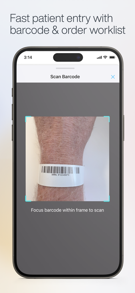 Exo Iris™ - A smartphone scanning a patient wristband barcode for fast data entry in the Exo Iris medical app