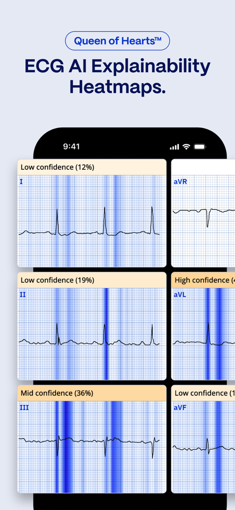 PMcardio for Individuals - PMcardio app screenshot showing ECG AI explainability heatmaps with confidence indicators on multiple heart leads