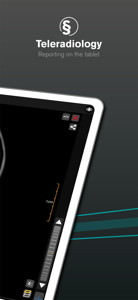 Interface de l'application mRay pour le reporting en téléradiologie sur une tablette