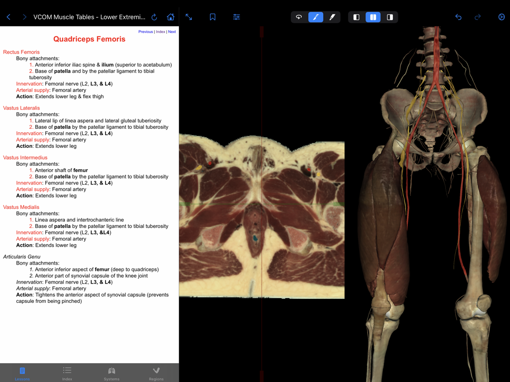 VH Dissector Pro - Split screen view of the VH Dissector Pro app featuring anatomical text about the quadriceps femoris alongside cross sectional and 3D human anatomy models