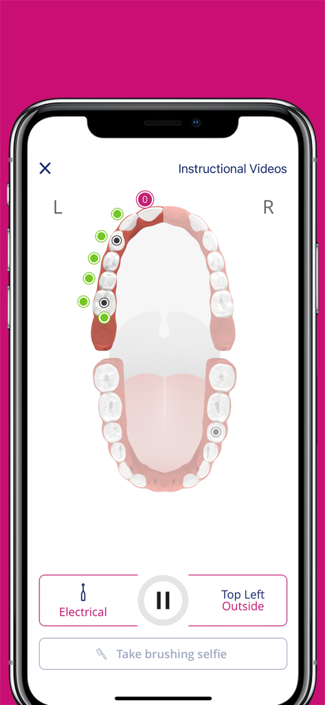 Dental Coach - Mobile app screen showing a visual tooth brushing guide with a personalized dental map and instructions for cleaning specific areas