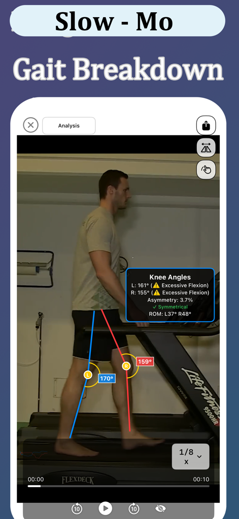 Interface d'analyse de la démarche au ralenti montrant les angles du genou et la détection de l'asymétrie lors de la marche sur un tapis roulant.