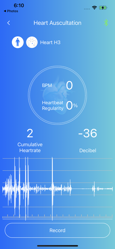 Interfaccia dell'app Skeeper Health Mate che mostra il monitoraggio dell'auscultazione cardiaca in tempo reale con dati BPM e forme d'onda