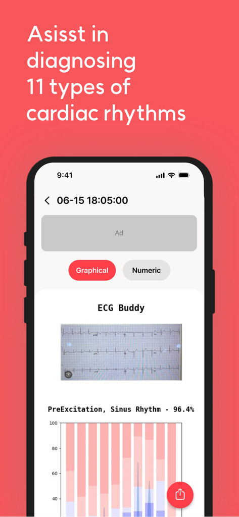 ECG Buddy - ECG Buddy mobile app interface showing cardiac rhythm analysis and a sinus rhythm diagnostic result with a bar graph.
