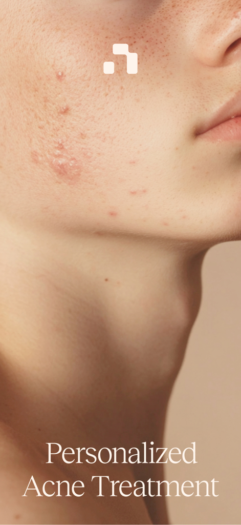 Nolla Acne - Close up of skin with acne and personalized treatment text