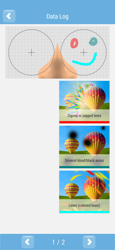 片頭痛オーラアプリのインターフェース。ジグザグ線やブラインドスポットなどの視覚障害を選択するオプションが表示されたデータログ画面が表示されています。