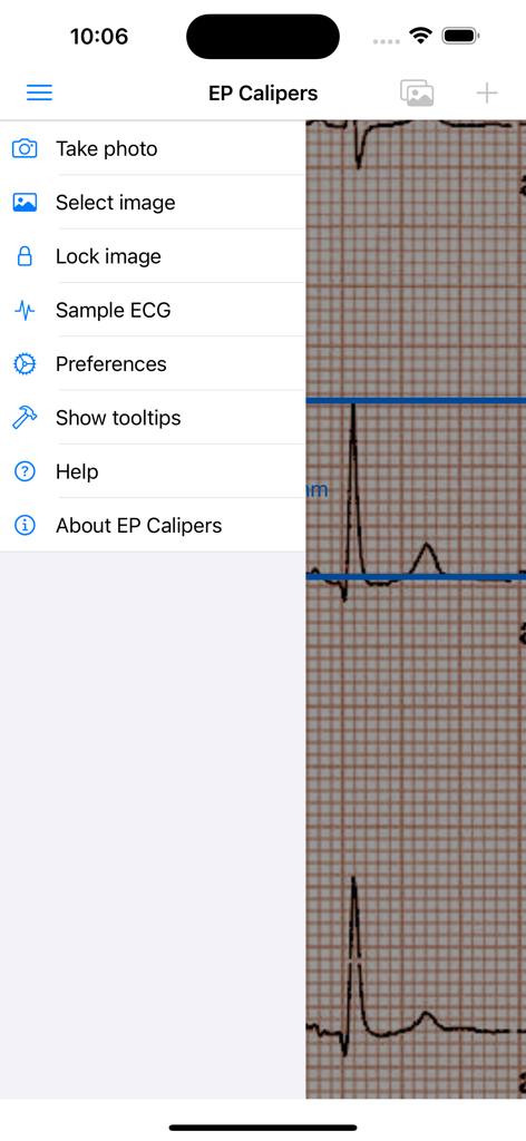 Main menu of the EP Calipers mobile app showing navigation options over an ECG rhythm strip.