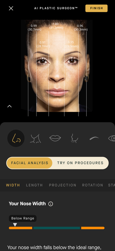 AI facial analysis interface of the AEDIT app showing nose width measurements and proportions on a woman's face.