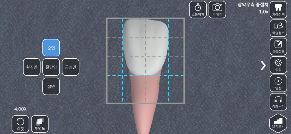 AR-D Morphology - 3D tooth anatomy model with measurement grid and carving guide interface