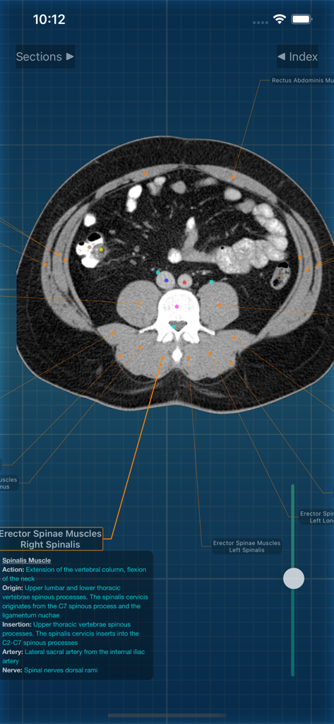 X-Anatomy Pro - Medical App | MWM