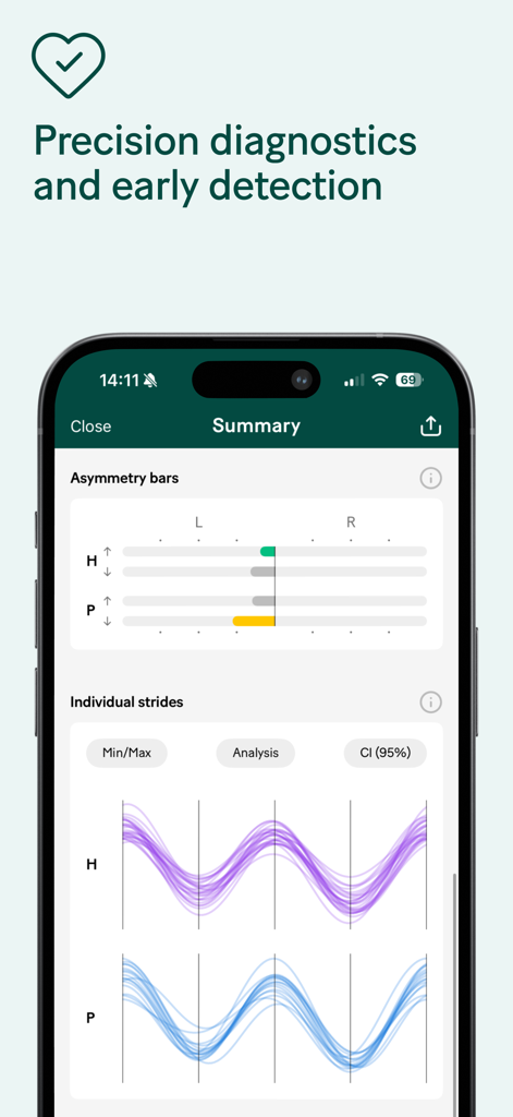 Sleip - Sleip app summary screen displaying equine gait asymmetry bars and individual stride analysis graphs