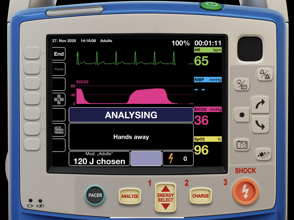 qubeX simulation of a Zoll Medical X Series monitor showing vital signs and cardiac analysis message