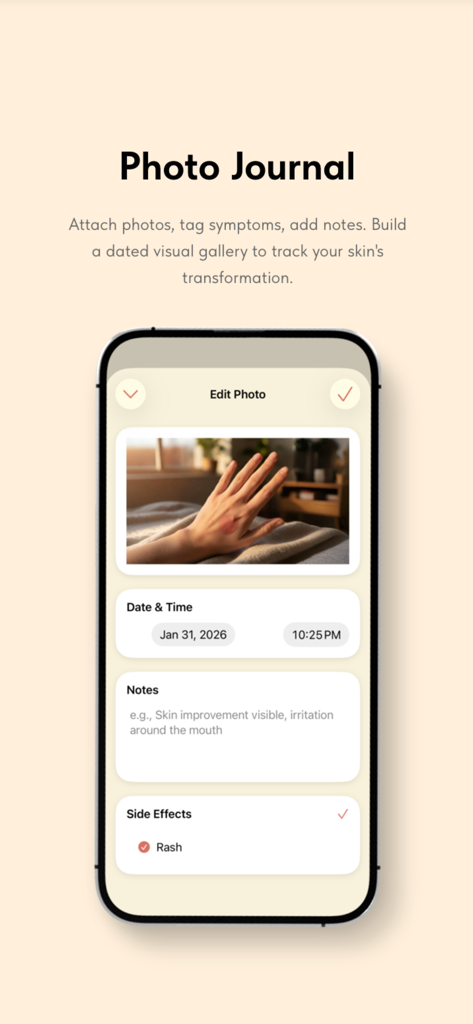 Iso - La pantalla del diario de fotos de Iso para documentar la transformación de la piel y los efectos secundarios