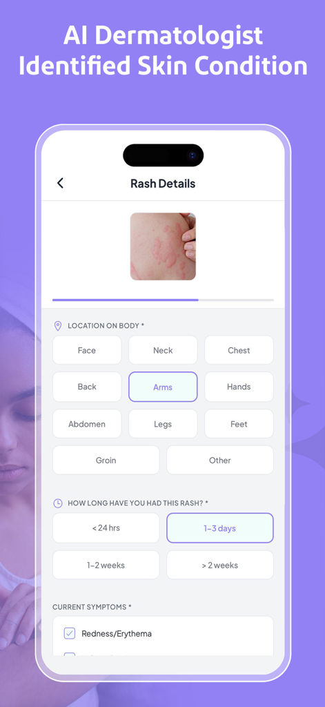 Mobile app screen for inputting skin rash symptoms and location for AI analysis