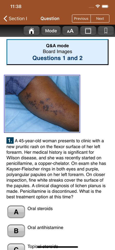 Practice question in the USMLE Images for the Boards app showing a dermatology case with a skin rash image