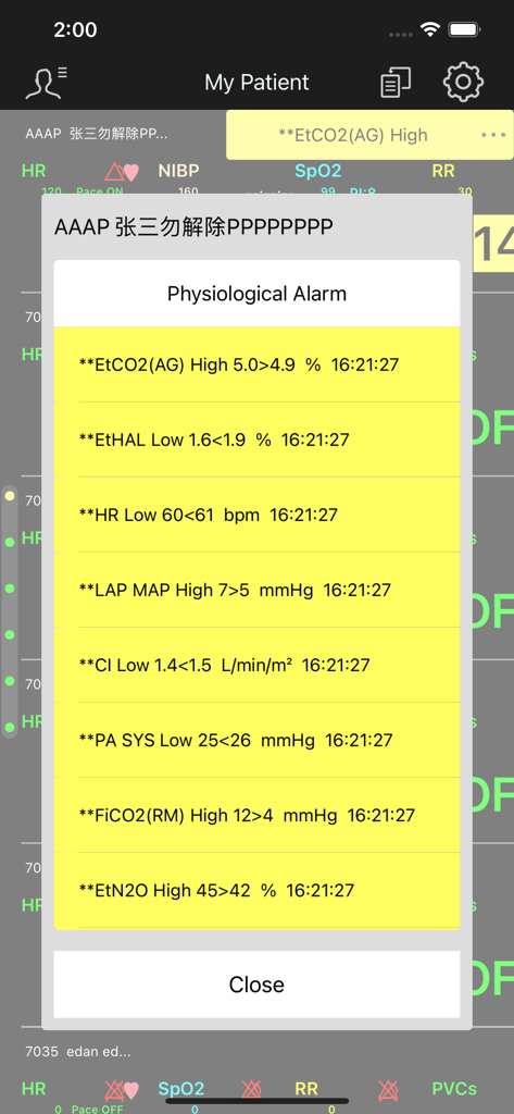 EDAN CMS - Interfaccia dell'app EDAN CMS che mostra un elenco di allarmi fisiologici e avvisi sui parametri vitali del paziente.