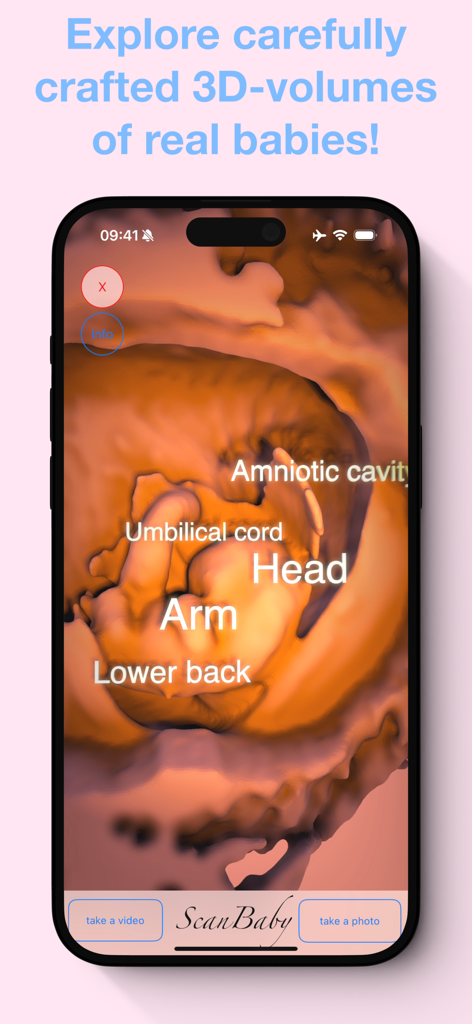 3D fetal ultrasound simulation with anatomical labels in ScanBaby app