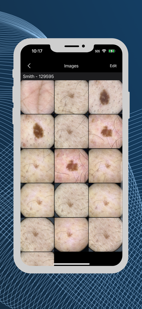 VEOS® DermaGraphix® - VEOS DermaGraphixアプリ内の皮膚病変やほくろの高解像度ダーモスコピー画像のグリッド。