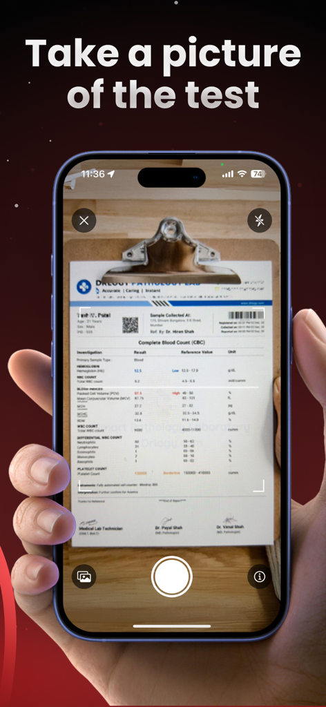 AI Blood Test Analyzer - A smartphone screen showing the AI Blood Test Analyzer app scanning a paper lab report