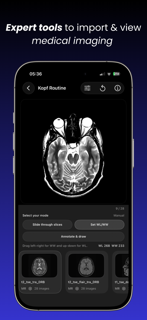 Dicom viewer MRI CT RX imaging - Pantalla de iPhone que muestra una resonancia magnética cerebral dentro de la aplicación Visor Dicom con herramientas para deslizarse por los cortes y ajustar los niveles de ventana.