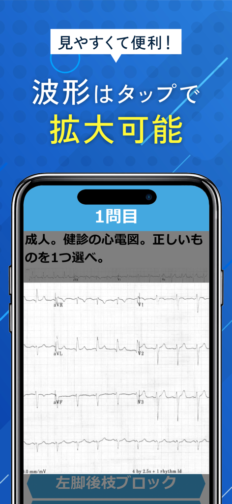 みんなde心電図 - Schermata dello smartphone che mostra una domanda del quiz sulla forma d'onda ECG con testo che indica che le forme d'onda possono essere ingrandite toccando per una migliore visibilità