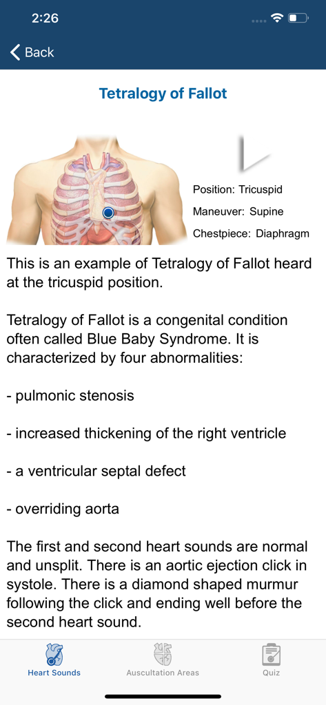 Heart Sounds Auscultation - Heart Sounds Auscultation app screen displaying clinical details and anatomical position for Tetralogy of Fallot