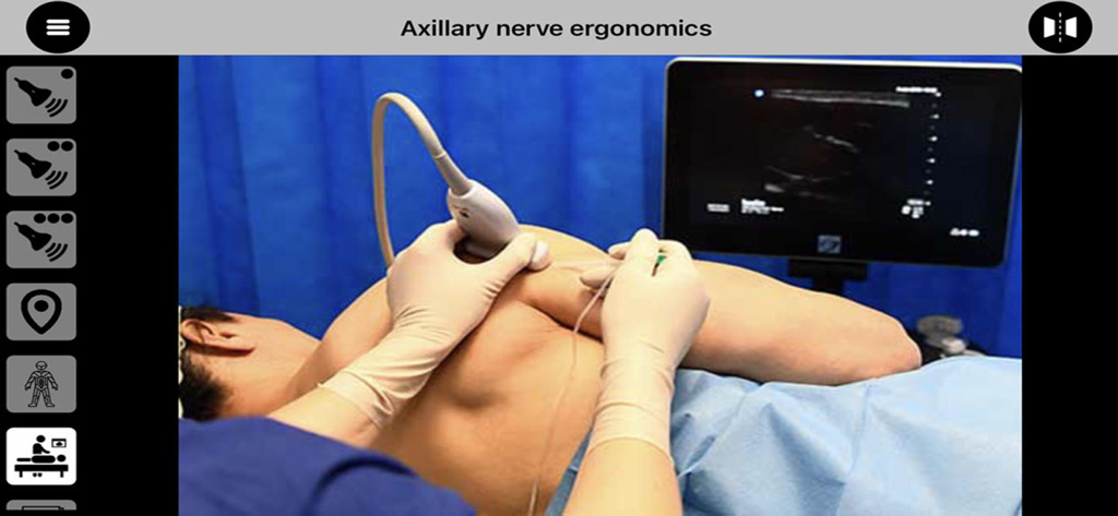 AnSo Pro - Profissional médico demonstrando ergonomia adequada para um ultrassom do nervo axilar