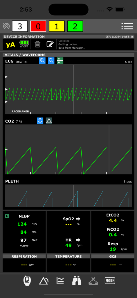 Professionelle medizinische Benutzeroberfläche der ADMS-App, die Patienten-EKG-Kurven und Vitaldaten für die klinische Überwachung anzeigt