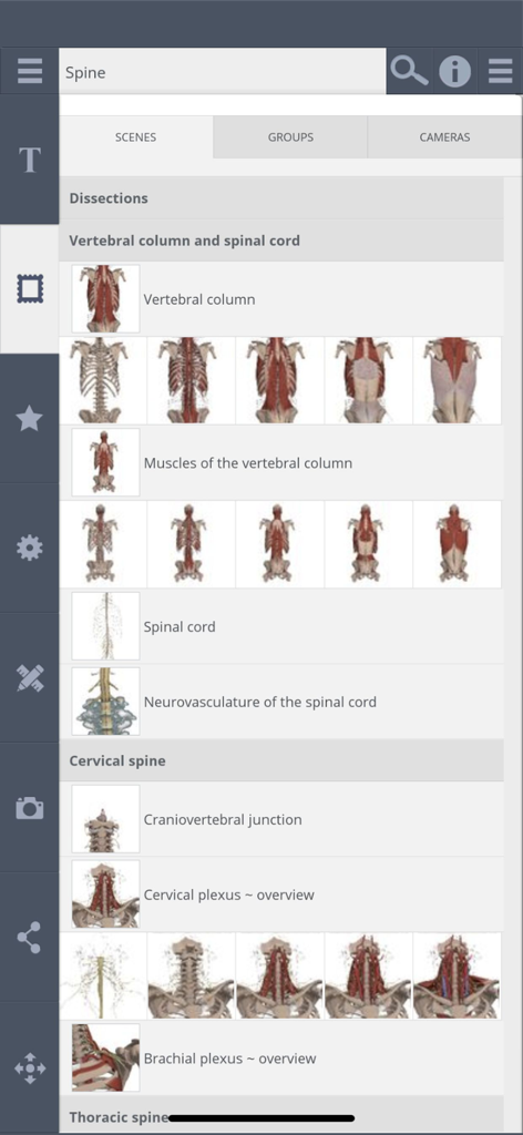 Primal's 3D Spine - Vista galleria di sezioni anatomiche per la colonna vertebrale e la colonna cervicale.