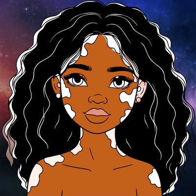 beautiful black girl with vitiligo