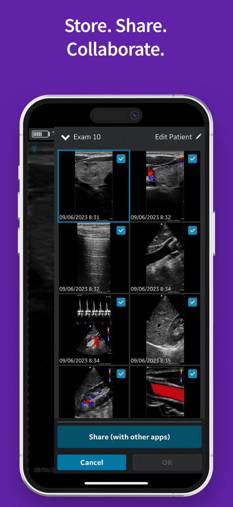 Interfaz de la aplicación Vscan Air que muestra una cuadrícula de imágenes de escaneo de ecografía seleccionadas para compartir con otras aplicaciones