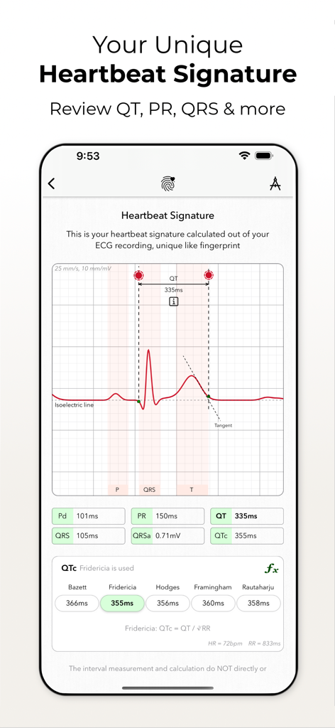 ECG+ | Your Watch ECG Reader - Detailed heartbeat signature analysis on the ECG plus mobile app showing cardiac intervals and waveform data.