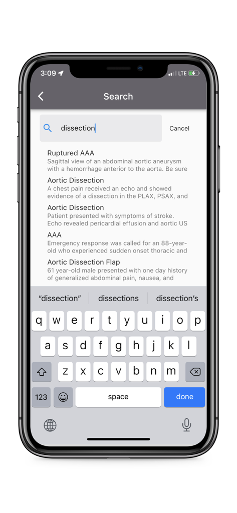 Search screen of The POCUS Atlas mobile app showing medical results for aortic dissection and ruptured AAA.