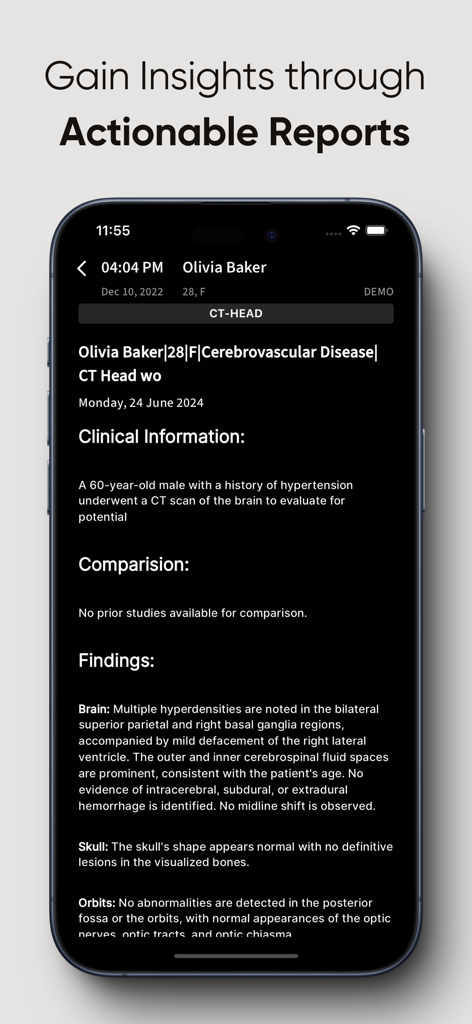 RadioView.AI mobile app displaying a detailed CT head scan medical report