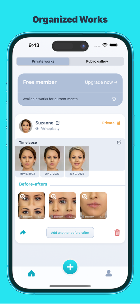 Dashboard dell'app iMed HIPAA che mostra lavori pazienti organizzati con timelapse e foto prima e dopo per trattamenti estetici.