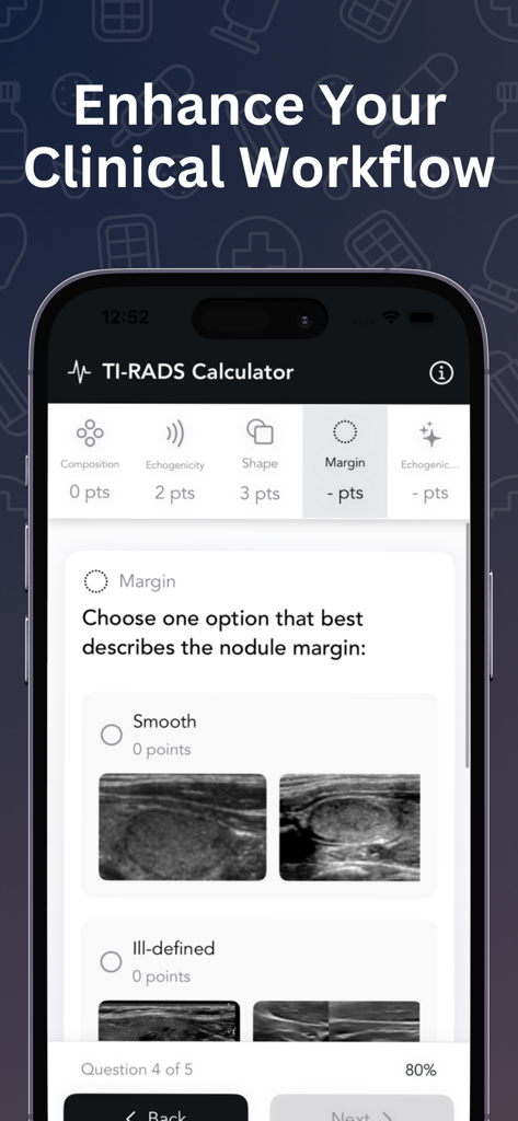 Easy TI-RADS Calculator mobile app interface showing the margin selection screen with thyroid ultrasound image references for clinical workflow