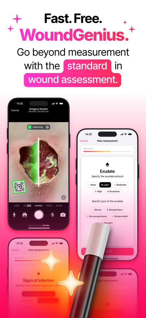 Interface da aplicação WoundGenius com medição digital de feridas e fluxo de trabalho de avaliação clínica.