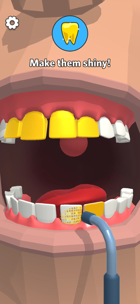 Dentist Bling - Uno strumento dentale che applica oro brillante su un dente in Dentist Bling