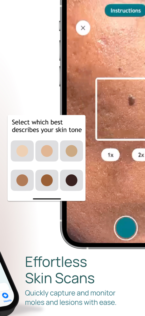 Mobile app interface showing a skin scan with skin tone selection options for mole monitoring