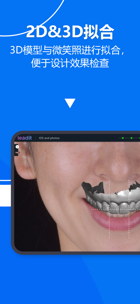 Interfaz de aplicación para profesionales dentales mostrando un modelo de diente 3D siendo ajustado en la foto de la sonrisa de un paciente.