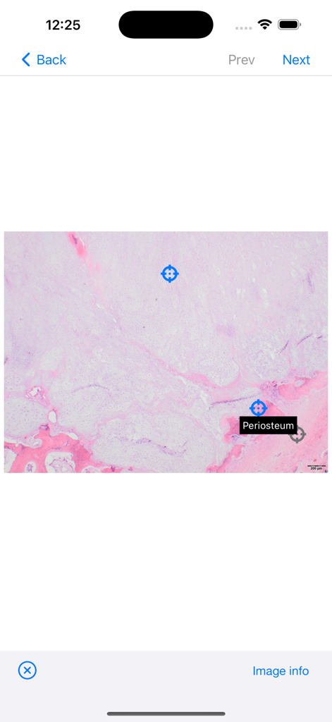 BoSTT - High resolution pathology slide with a labeled periosteum marker in the BoSTT app