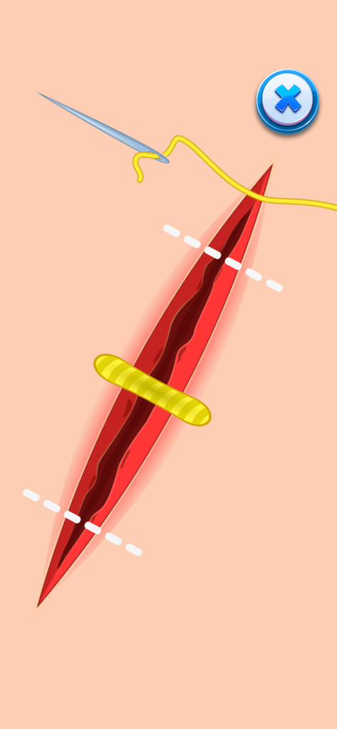 Medical Doctor Hospital Games - Close-up de uma ferida cirúrgica sendo costurada com agulha e linha amarela em um jogo de simulação de médico