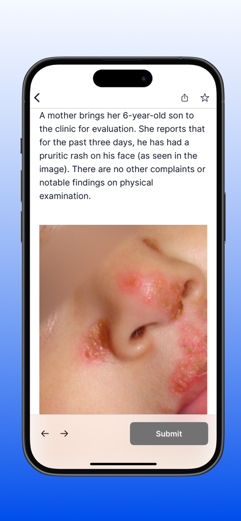 PANCE PANRE Mastery Test 2026 - PANCE PANRE Mastery app interface showing a clinical practice question with an image of a pediatric facial rash