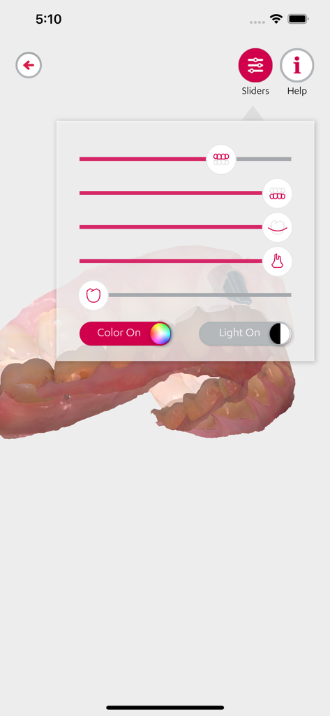Interface of the 3Shape Communicate app showing adjustment sliders over a 3D dental scan