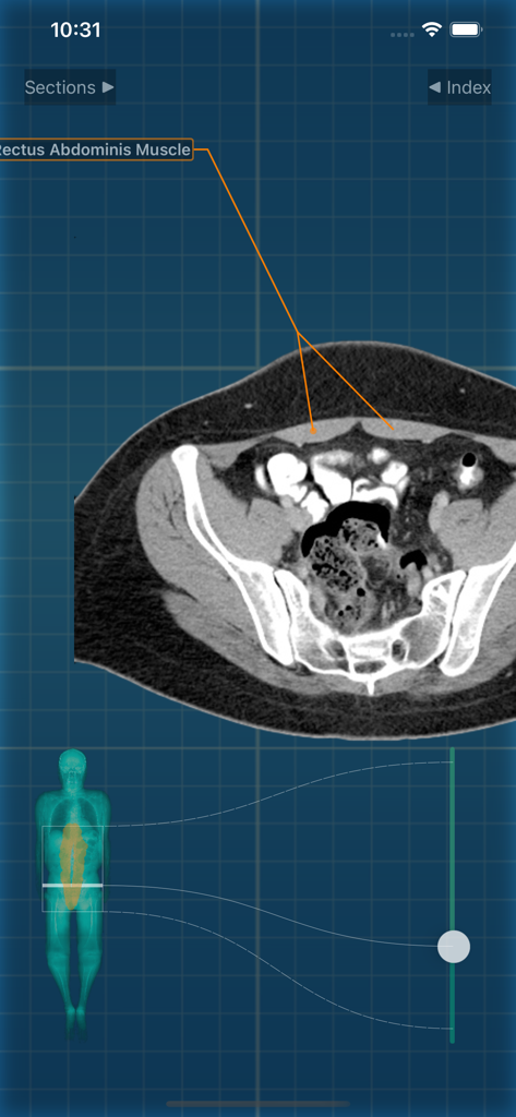 X-Anatomy Pro - Medical App | MWM