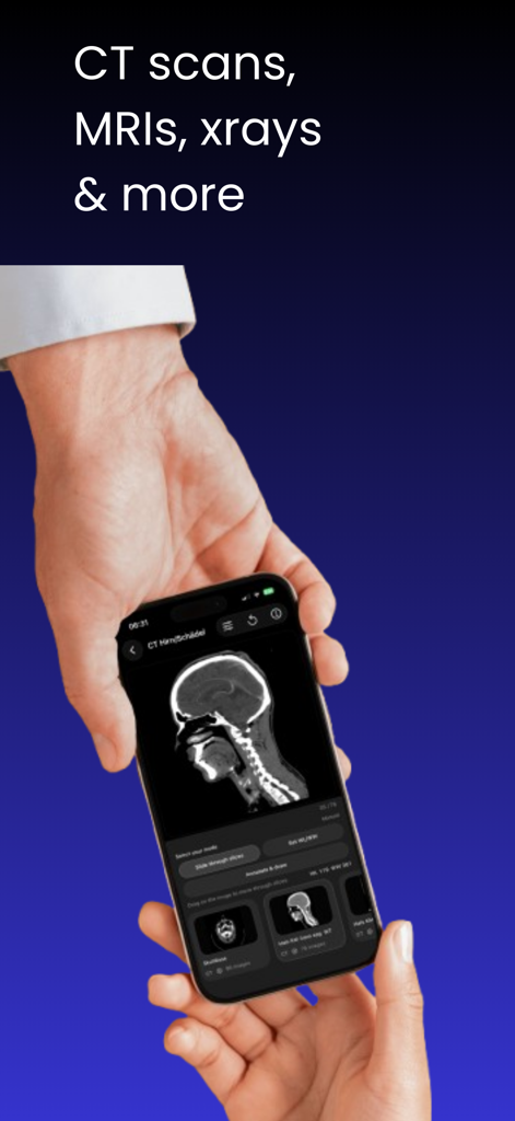 Dicom viewer MRI CT RX imaging - Persona sosteniendo un smartphone que muestra una imagen de tomografía computarizada en una aplicación de visualización de imágenes médicas