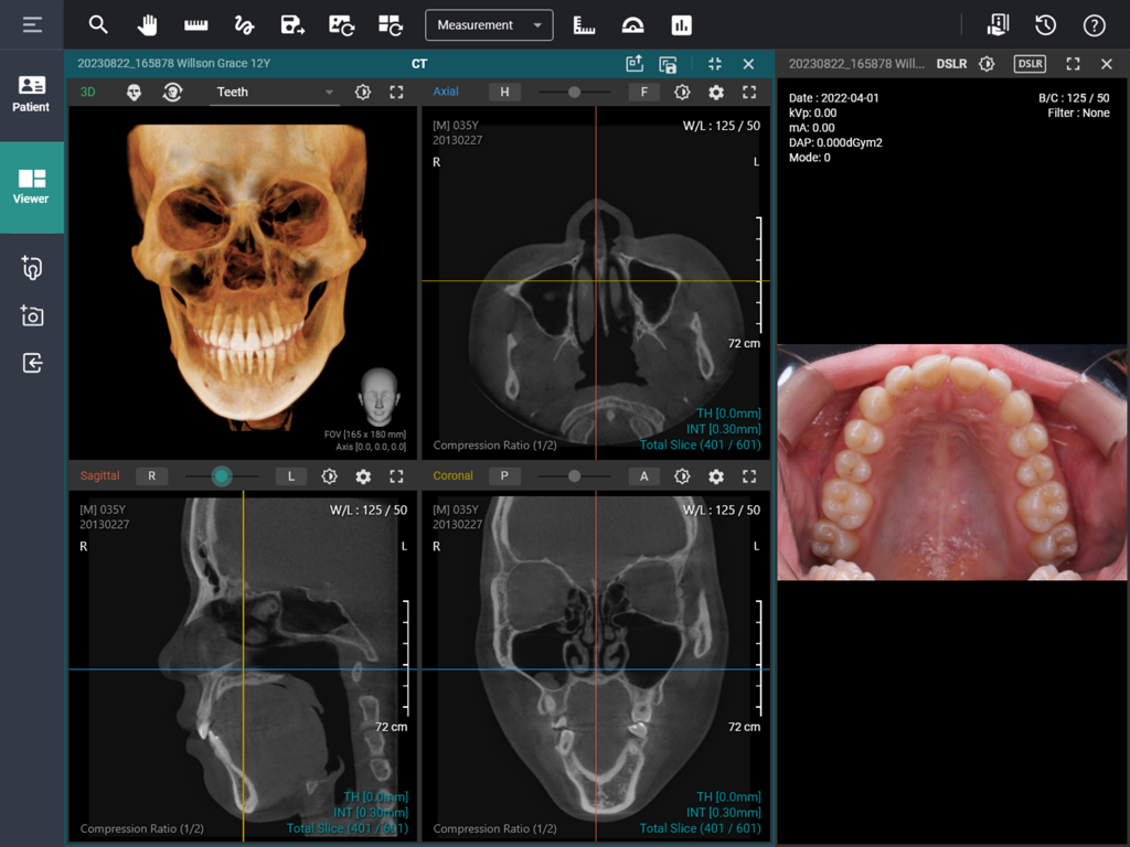 La interfaz clínica de EzDent Web que muestra la reconstrucción 3D del cráneo y vistas de TC dental.