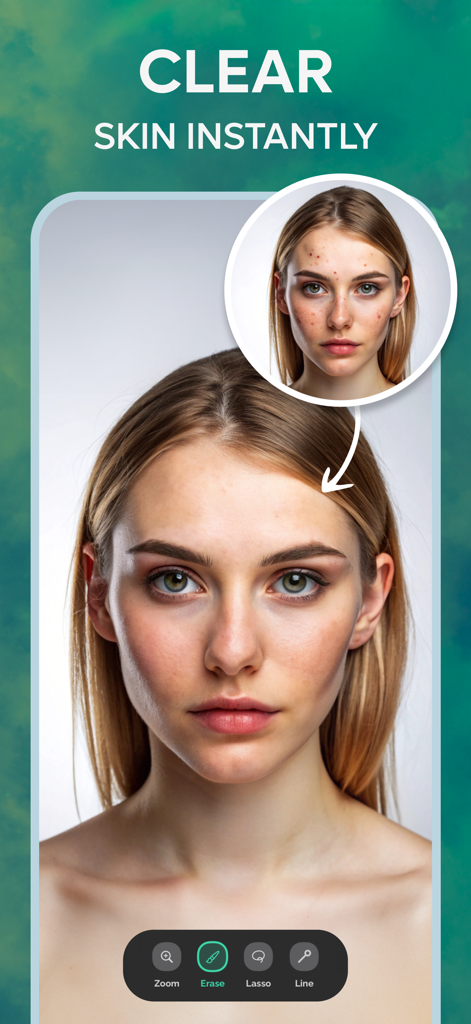 Remove Objects, Photo Eraser - Dimostrazione prima e dopo della rimozione di imperfezioni della pelle e acne utilizzando l'app Photo Eraser IA